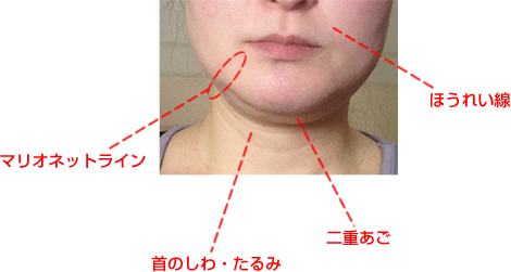 ブルドッグ顔の特徴の説明図